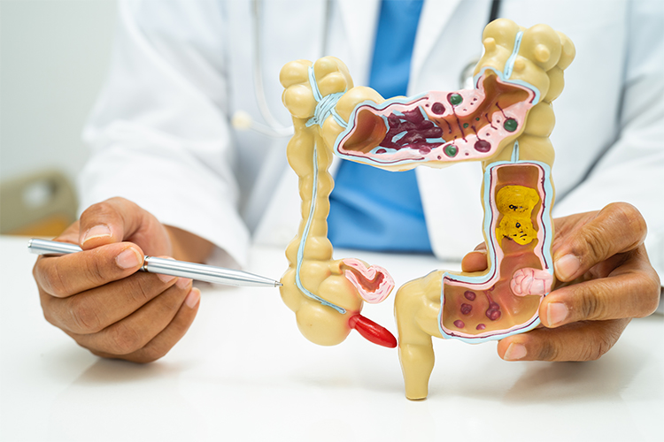 Understanding Piles, Fissures, and Fistulas: Key Differences and Treatment Options