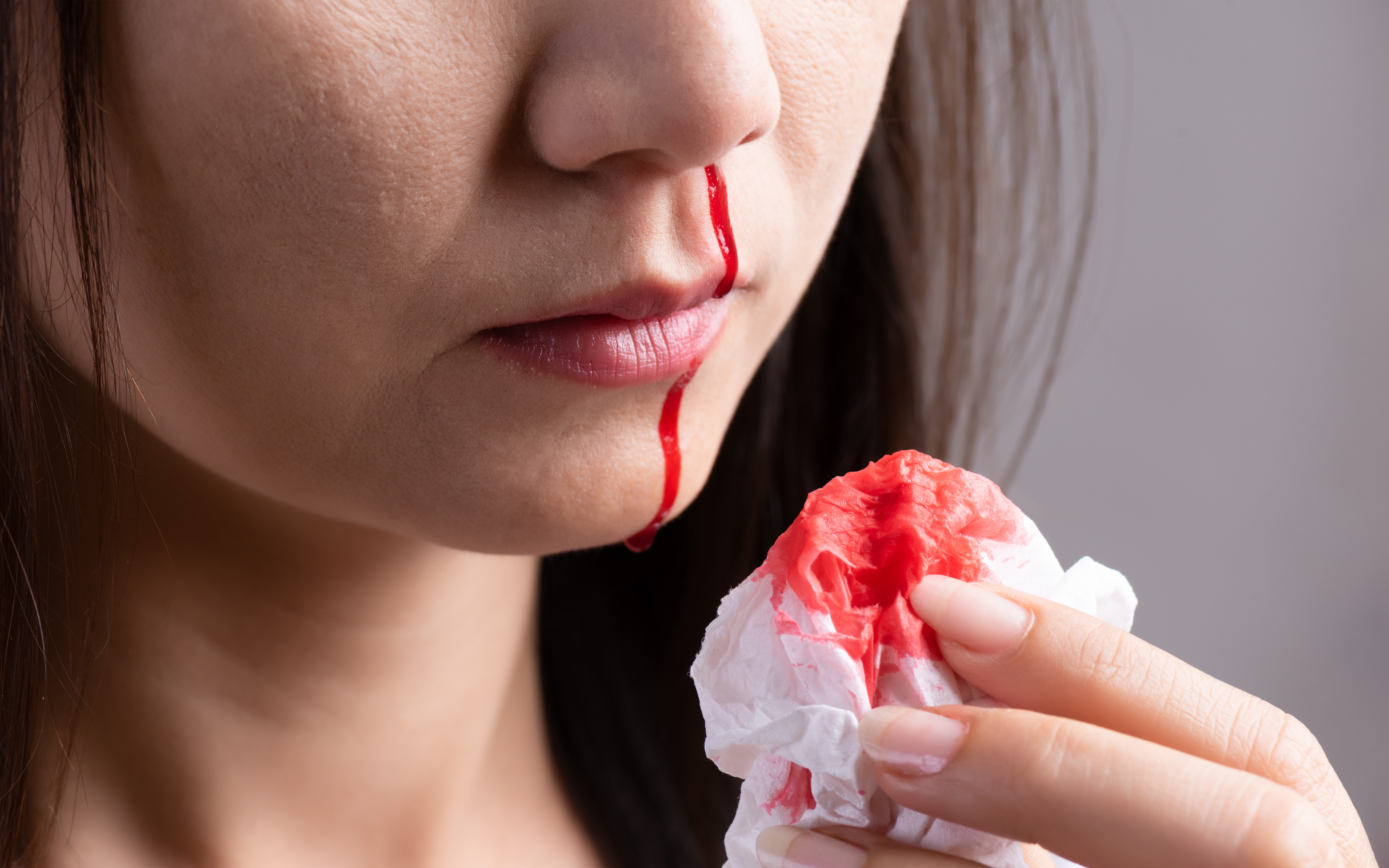 Summer Nosebleeds: Causes, Effects, and Prevention