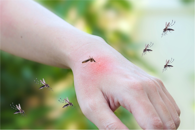 Comprehensive Guide to Dengue Virus Natural Treatment