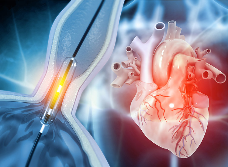 Advanced Cardiology Treatments For Cardiac Diseases