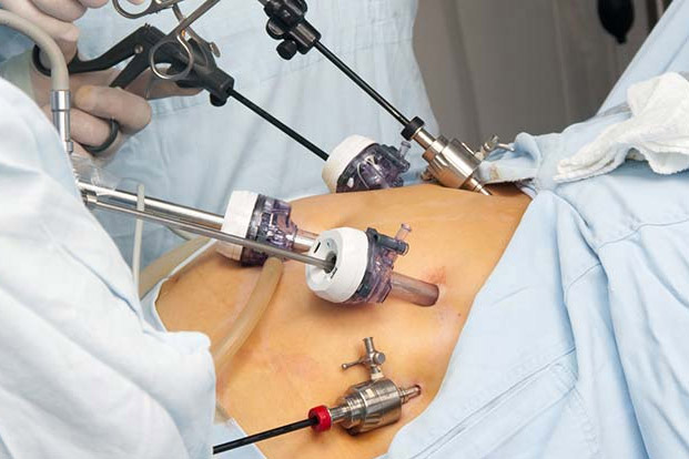 Minimal Invasive Surgery can help in Poly trauma