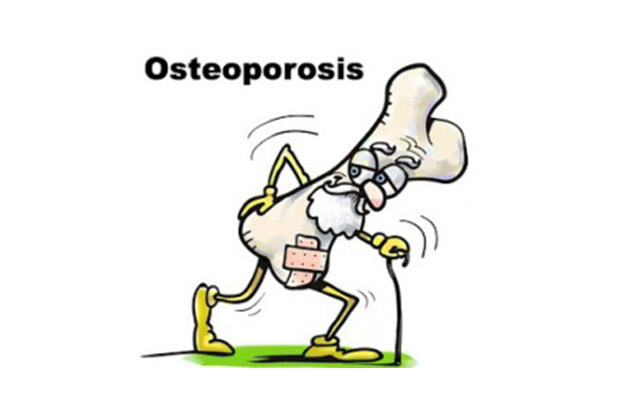 Six Preventive Measures for Osteoporosis