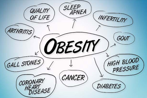 What causes Obesity? Why am I getting fat?