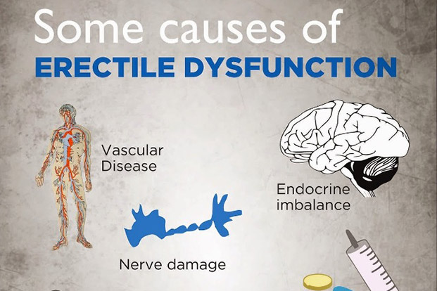 Tips to Overcome Erectile Dysfunction