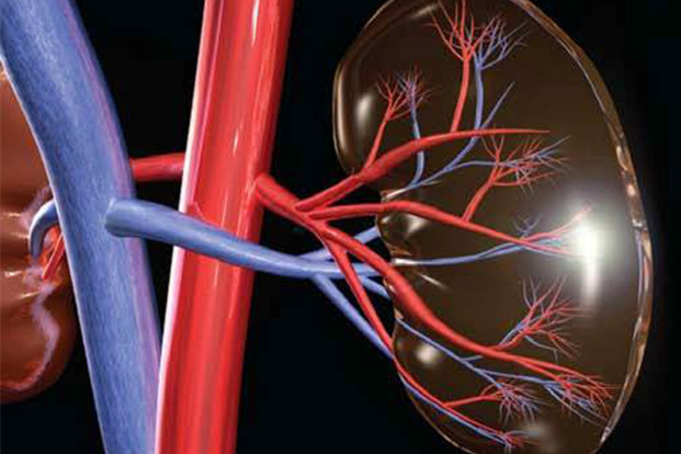 Causes of Kidney Stones
