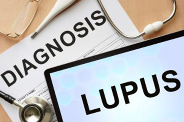 Lupus –Treatment, Precautions & Prevention