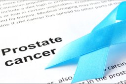 Diagnosis Prostate Cancer