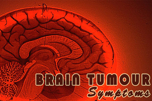 Symptoms and Causes of Brain Tumor