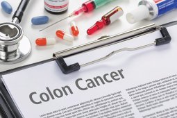 Symptoms of Colon Cancer