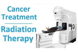 Radiation Therapy for Cancer Treatment