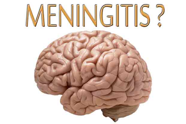 Meningitis disease
