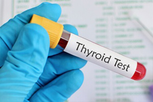 Thyroid test 