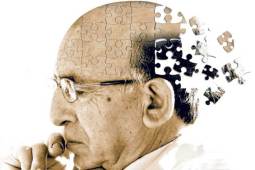 Risk Factors for Alzheimer's Disease