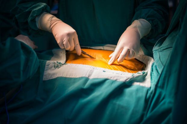 types of heart bypass surgeries