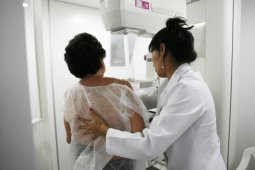 WHAT IS A MAMMOGRAM? HOW OFTEN SHOULD WOMEN HAVE A MAMMOGRAM?