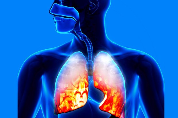 Pneumonia Disease & Its types