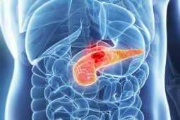 What is Pancreatic Cancer? Signs and Symptoms of Pancreatic Cancer