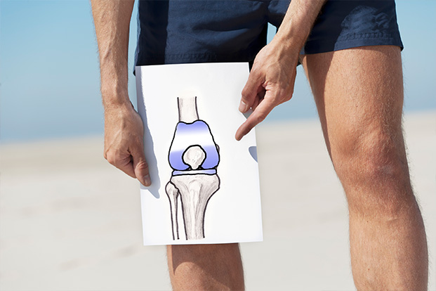 What is Knee Replacement and its Myths & Facts