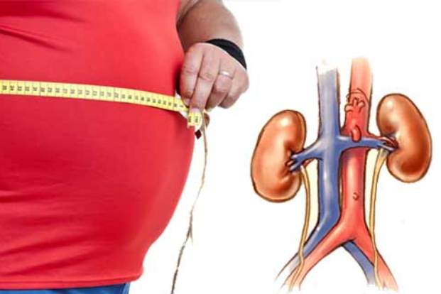 The Effect of Obesity on Chronic Kidney Disease