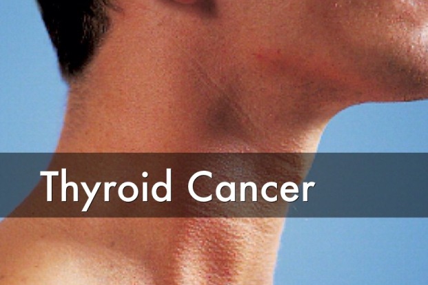 Types of Thyroid Cancer