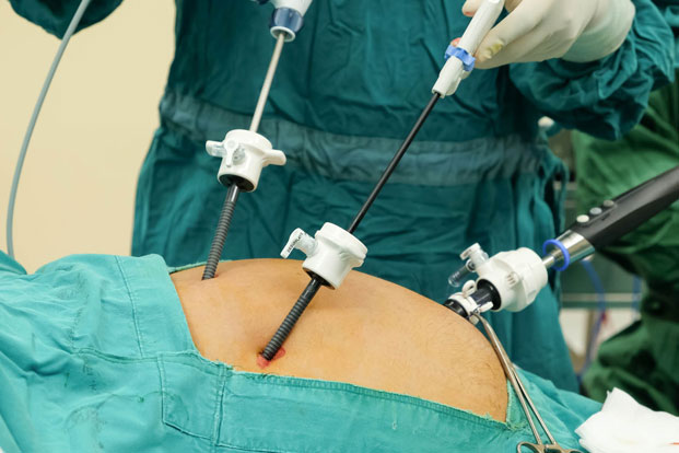 पारस एचएमआरआई सुपर स्पेशिलिटी हाॅस्पीटल में एडवांस लैप्रोस्कोपिक सर्जरी की सारी सुविधाएॅ उपलब्ध