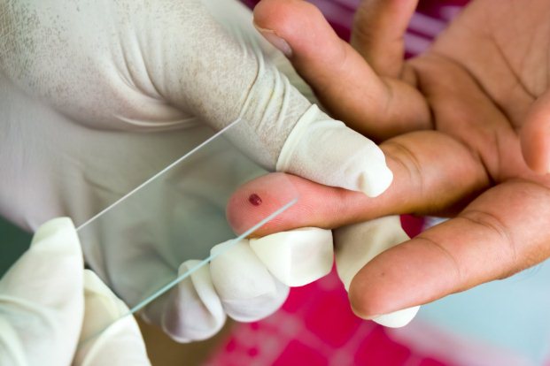 How Is Malaria Diagnosed?