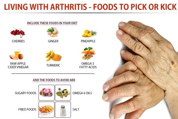 Arthritis Tips 