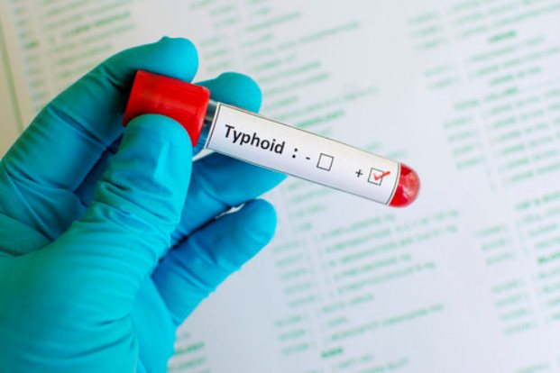 Tips to avoid Typhoid