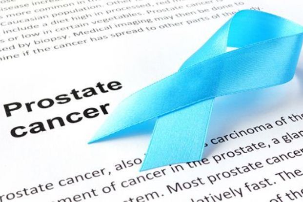 Early stage prostate cancer : Overview