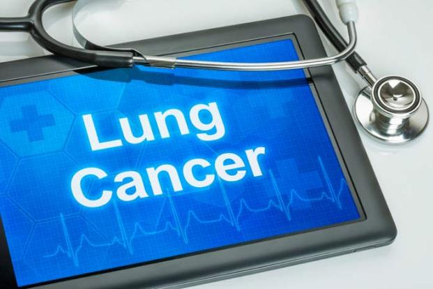 Lung Cancer in India - Are We Witnessing an Epidemic?
