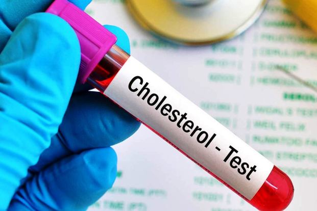 How to get our cholesterol tested ?