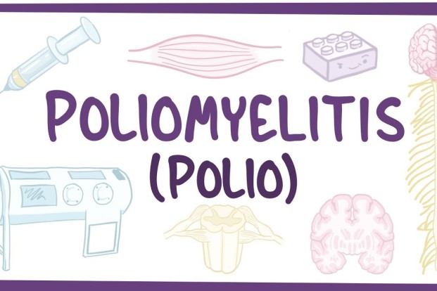 What are the symptoms of Polio and its types ?