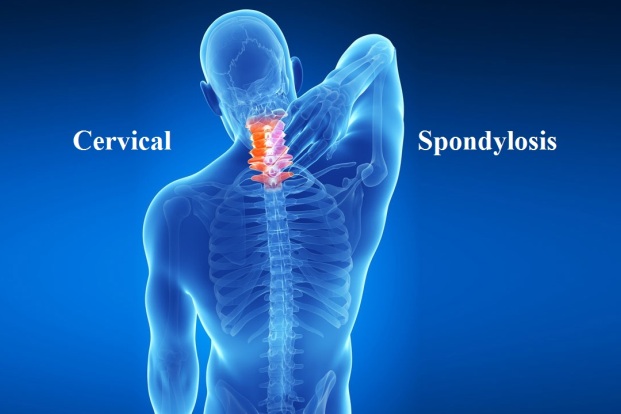 Cervical Degenerative Disc Disease Causes Symptoms