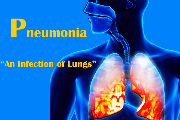 Is pneumonia contagious?