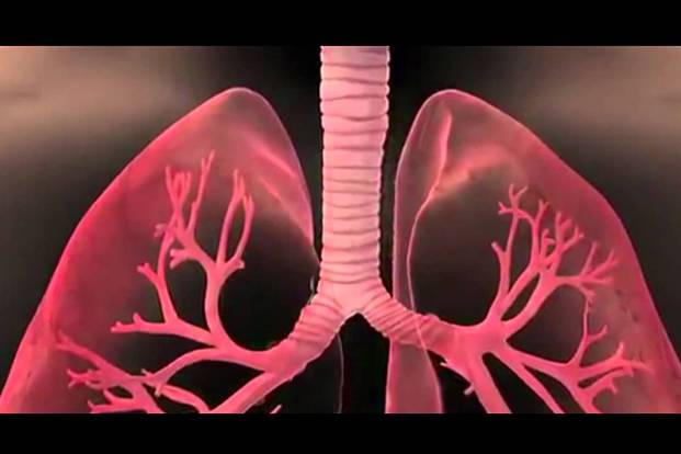 Lung issues that Air Pollution can cause