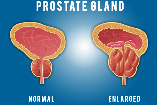 What is the role of the prostate gland?
