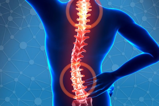 Symptoms and treatment of deformities of spine