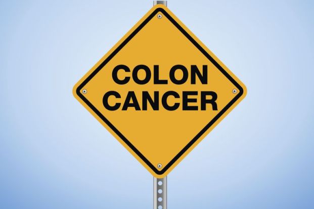 Colorectal (Colon) Cancer: Overview and Signs and Symptoms