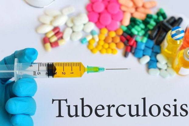 Tuberculosis: Treatment and Diagnosis
