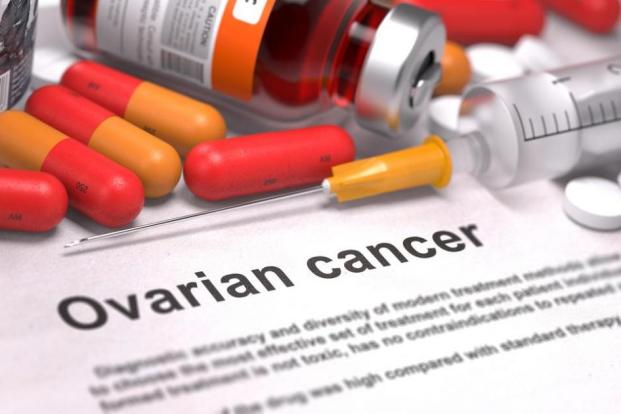Can Ovarian Cancer Be Prevented?