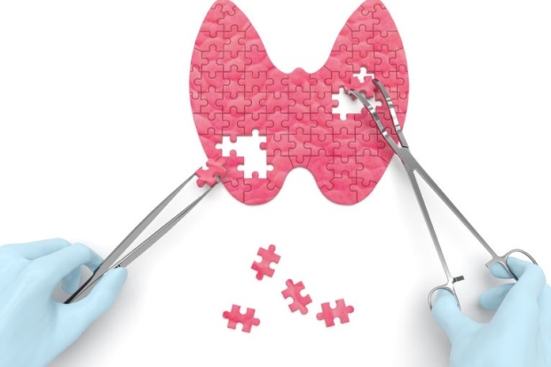 Types of Thyroid surgery