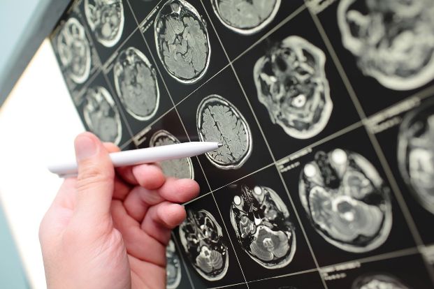 Do all brain tumors need to be removed