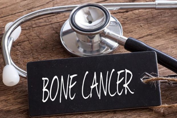 Bone Cancer Screening Process