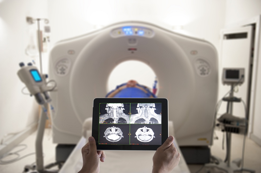 Know About PET-CT Scan