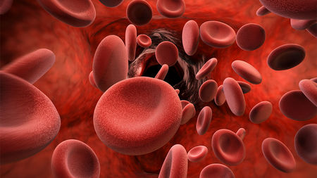 Know all about Thalassemia