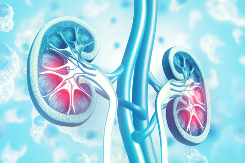 kidney transplant or dialysis