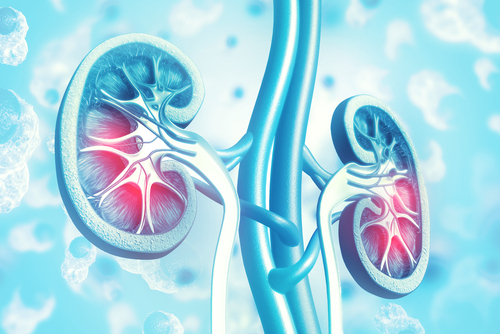 Kidney Transplantation or Dialysis